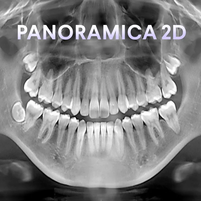 Esempio di panoramica 2D