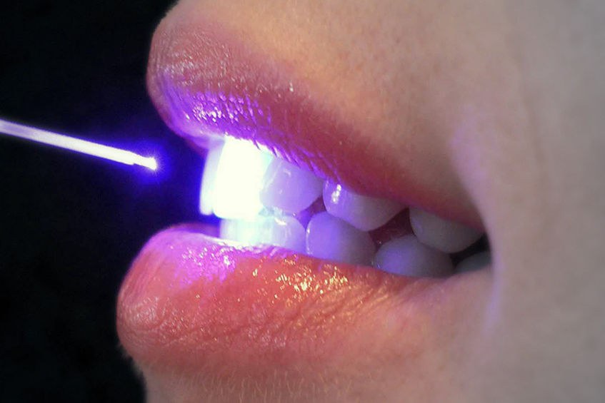 Odontoiatrica Laserterapia