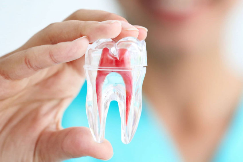 Odontoiatrica Devitalizzazione denti