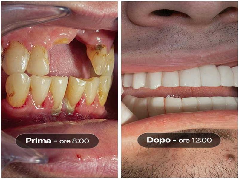 Pre e post del caso numero 16